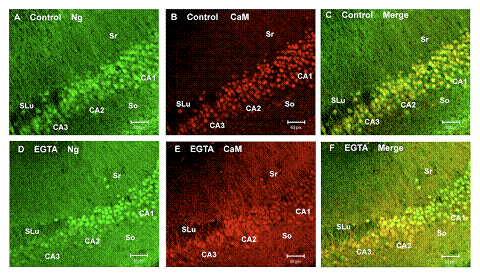 Distinctive Ca2+-sensitive translocation of Ng and CaM among the hippocampal neurons in the CA 1 versus those in the CA 2 and CA 3 regions.