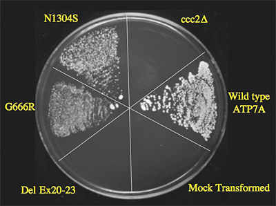 Figure 1. Yeast complementation assay predicts responsivity to early treatment in Menkes disease.