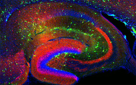 Figure 1. Interneurons in the GAD-65 GFP mouse