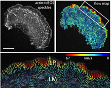 Mitochondria morphology in NRK cells