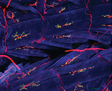 Blue striated muscle with red, blue, and green antibodies