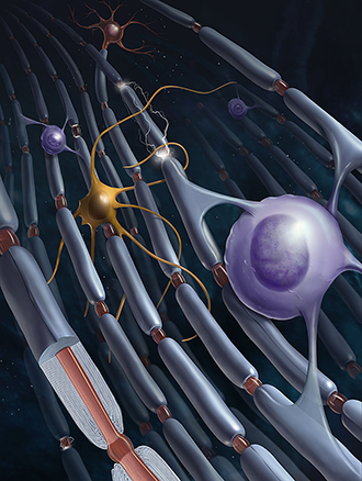An artist's rendering of myelin sheaths and oligodendrocytes