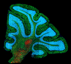 Three-color NPC1 cerebellum