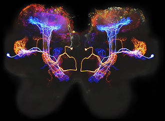Three-color NPC1 cerebellum