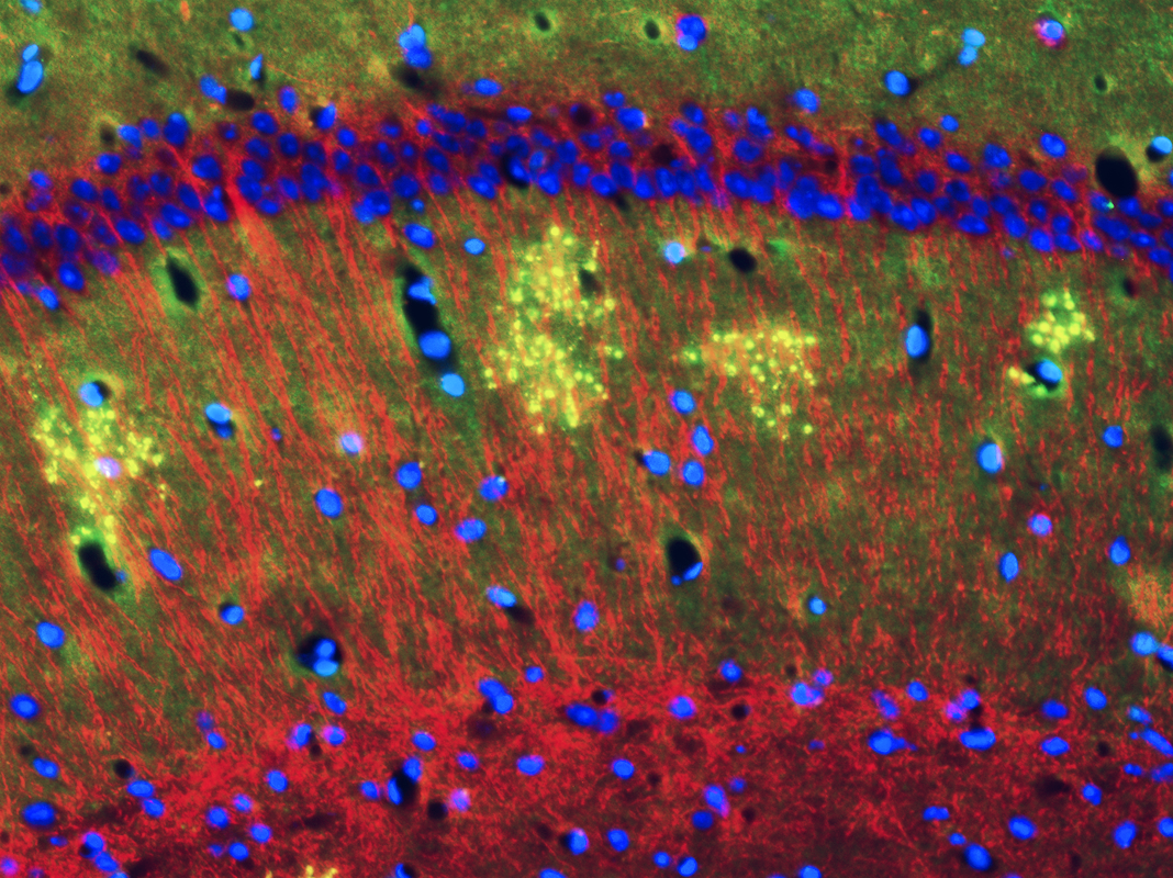 Mouse hippocampus in shades of green, red, blue, and yellow