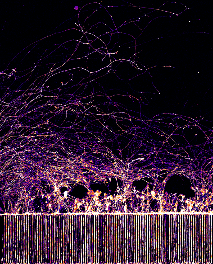 Human neuronal axons growing on microfluidic chambers